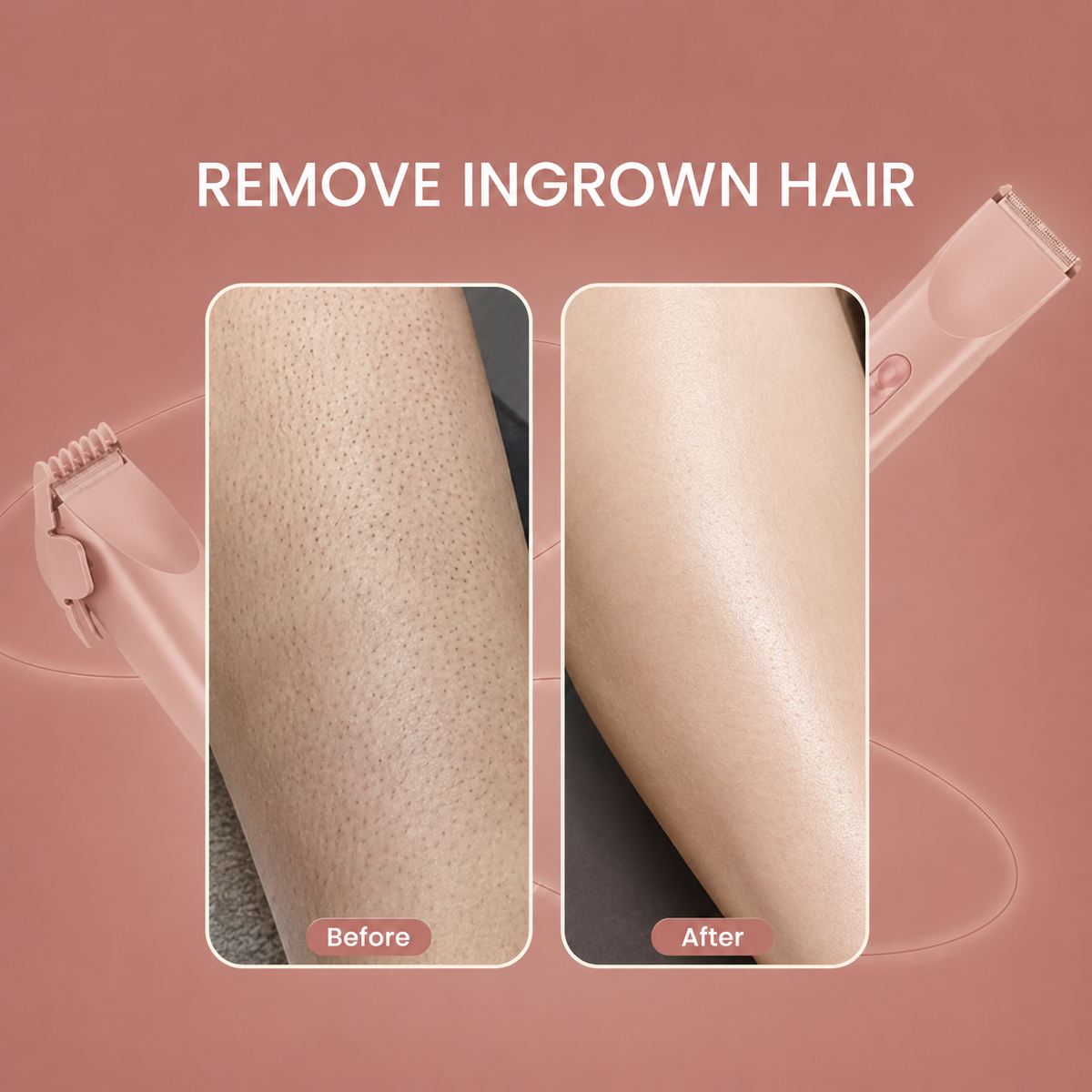 2 in 1 Women Body Shaver