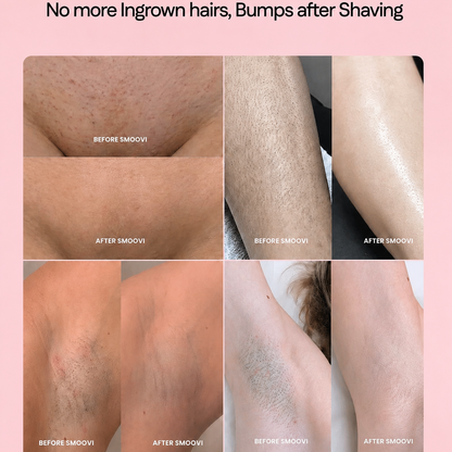 Ouhoe - Hair Removal Spray